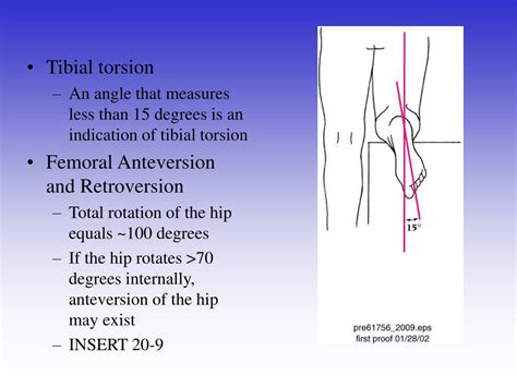 tibial torsion measurements